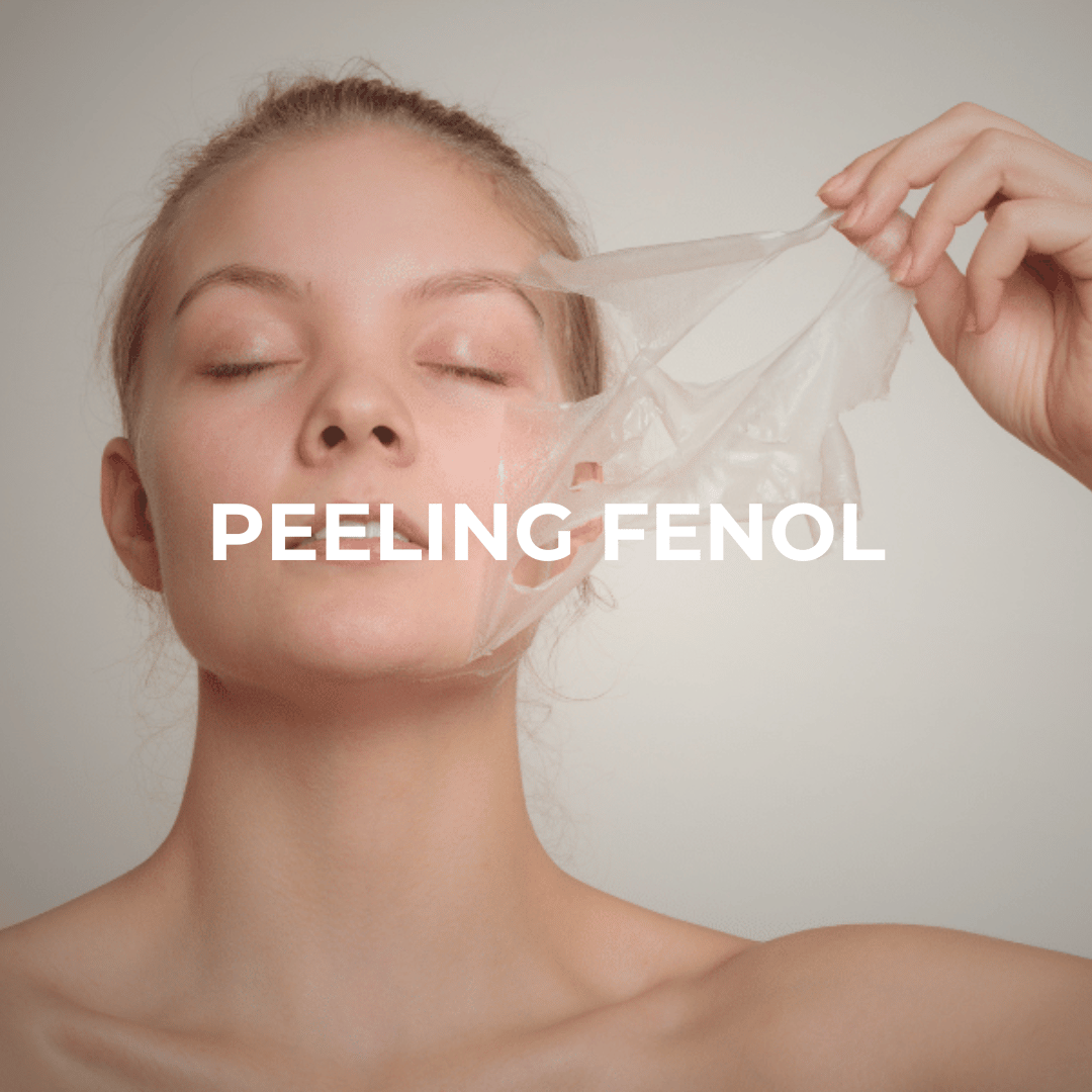 Peeling de Fenol Peeling de Fenol
