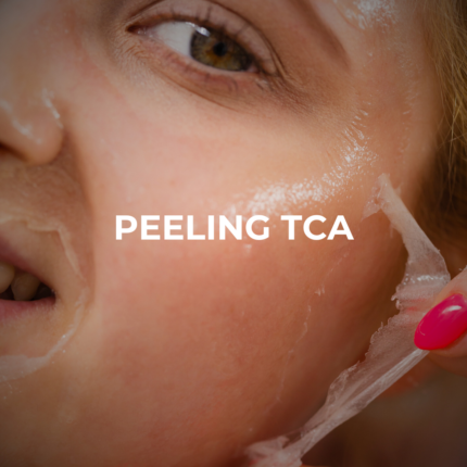 Peeling TCA
